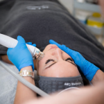 Radiofrekvenčni microneedling: kaj je, kako deluje in ali je primeren za vas?